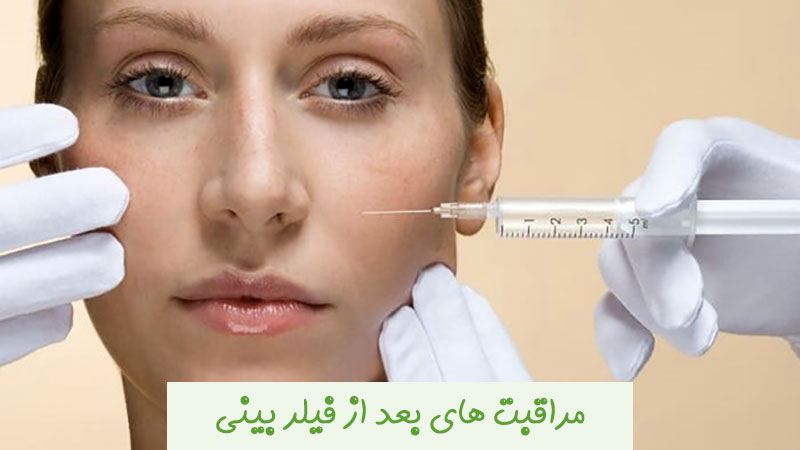 مراقبت های بعد از فیلر بینی