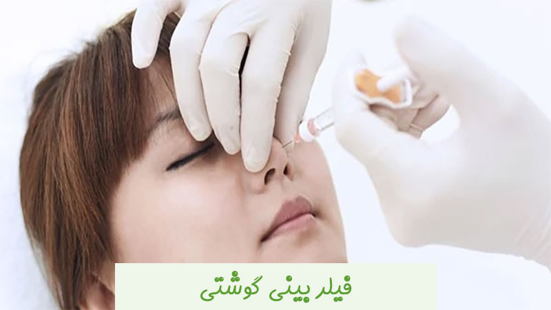 فیلر بینی گوشتی